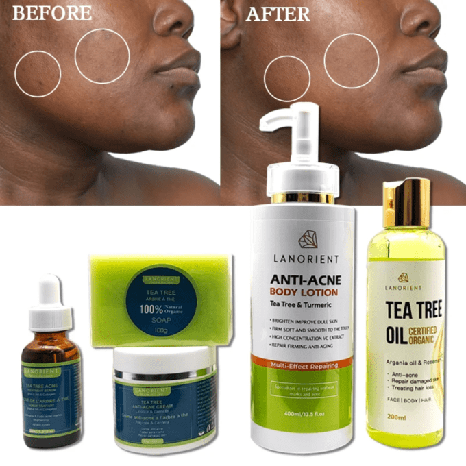 GAME REPARATEUR ANTI-BOUTON CORP ET VISAGE